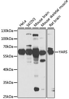 YARS Antibody in Western Blot (WB)