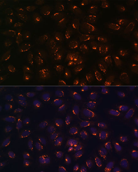 GALNT2 Antibody in Immunocytochemistry (ICC/IF)