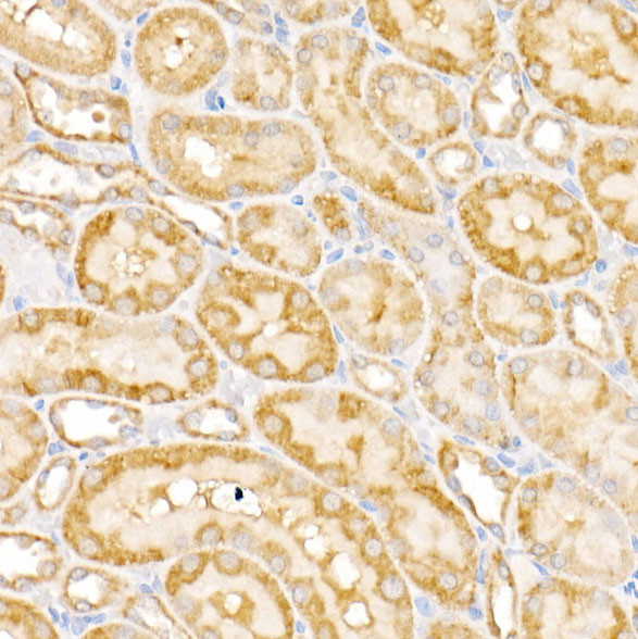 GALNT2 Antibody in Immunohistochemistry (Paraffin) (IHC (P))