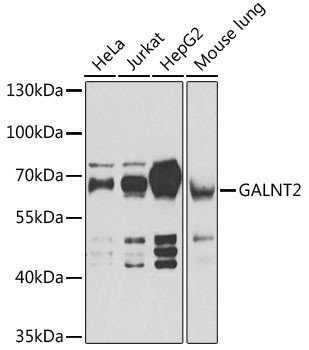 GALNT2 Antibody in Western Blot (WB)