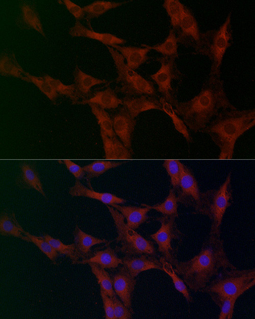 GOT2 Antibody in Immunocytochemistry (ICC/IF)