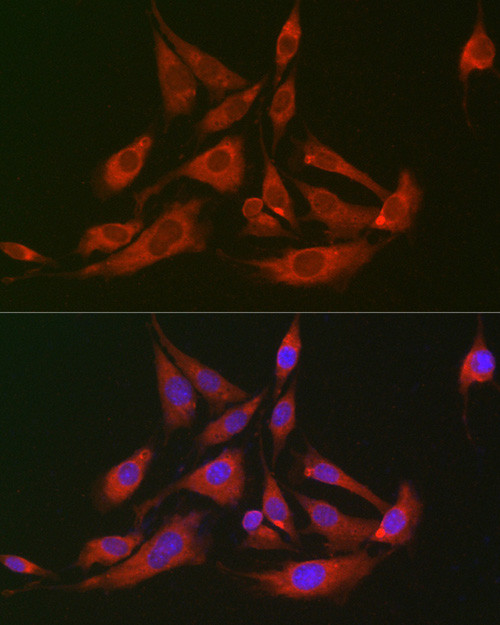 GOT2 Antibody in Immunocytochemistry (ICC/IF)