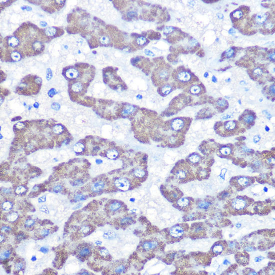 GOT2 Antibody in Immunohistochemistry (Paraffin) (IHC (P))