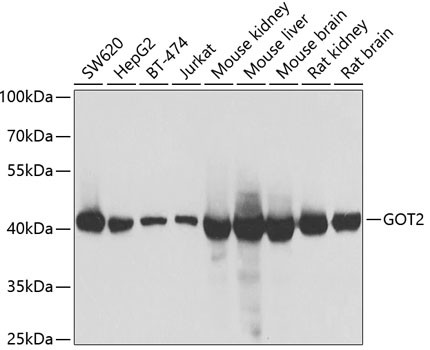 GOT2 Antibody in Western Blot (WB)