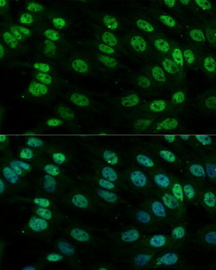 hnRNP M Antibody in Immunocytochemistry (ICC/IF)