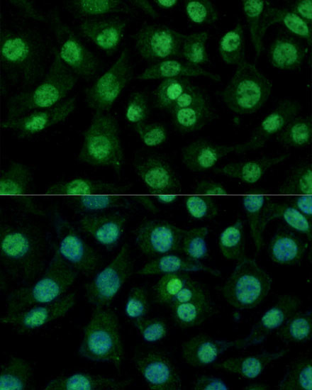 hnRNP M Antibody in Immunocytochemistry (ICC/IF)