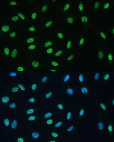 hnRNP M Antibody in Immunocytochemistry (ICC/IF)