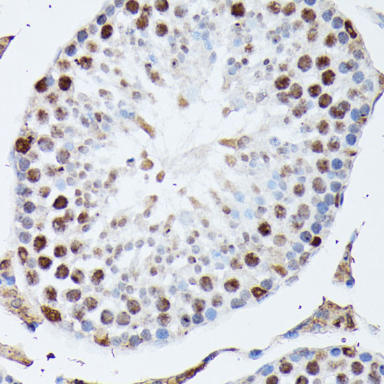 hnRNP M Antibody in Immunohistochemistry (Paraffin) (IHC (P))