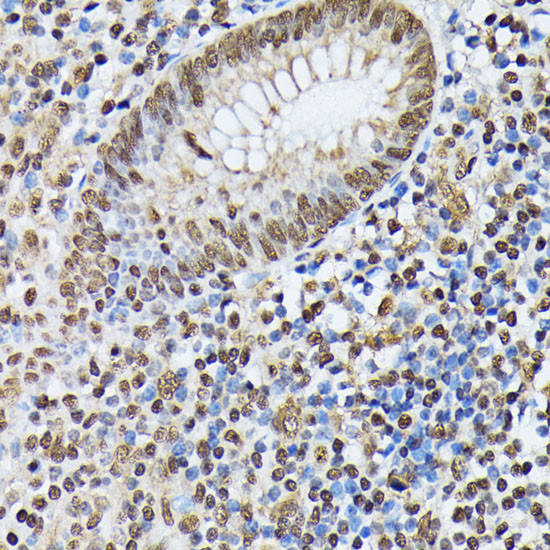 hnRNP M Antibody in Immunohistochemistry (Paraffin) (IHC (P))