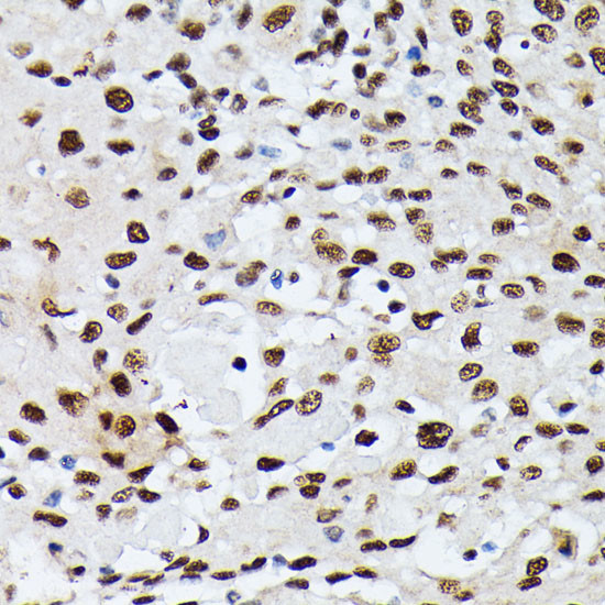 hnRNP M Antibody in Immunohistochemistry (Paraffin) (IHC (P))