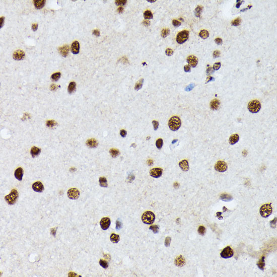 hnRNP M Antibody in Immunohistochemistry (Paraffin) (IHC (P))