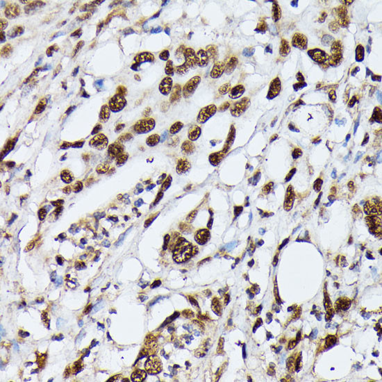 hnRNP M Antibody in Immunohistochemistry (Paraffin) (IHC (P))