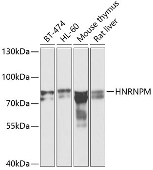 hnRNP M Antibody in Western Blot (WB)