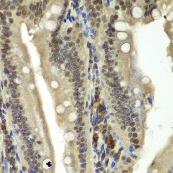 RBBP5 Antibody in Immunohistochemistry (Paraffin) (IHC (P))