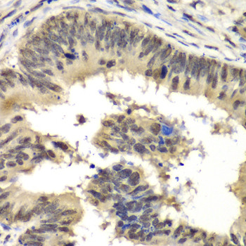 RBBP5 Antibody in Immunohistochemistry (Paraffin) (IHC (P))