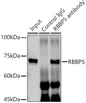 RBBP5 Antibody in Immunoprecipitation (IP)
