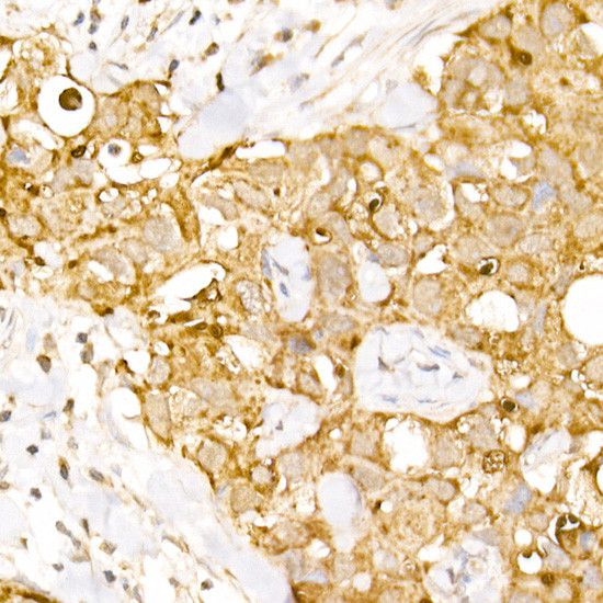 AP3B1 Antibody in Immunohistochemistry (Paraffin) (IHC (P))