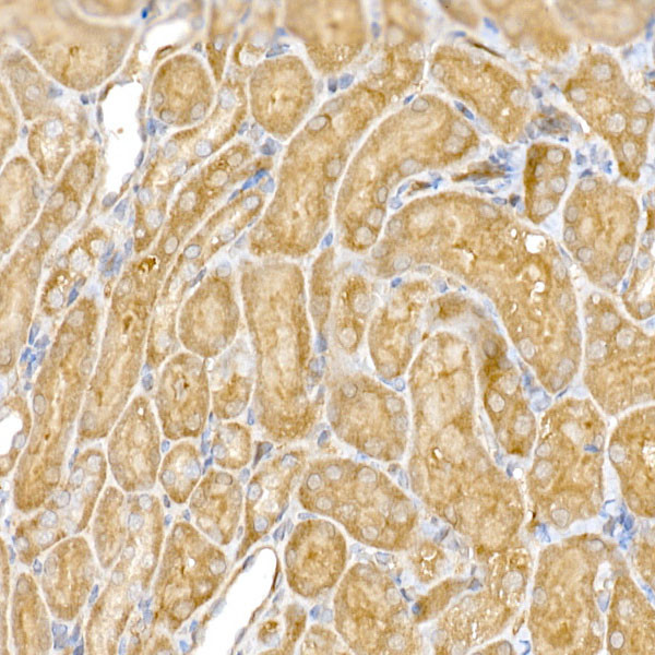 CLIC4 Antibody in Immunohistochemistry (Paraffin) (IHC (P))