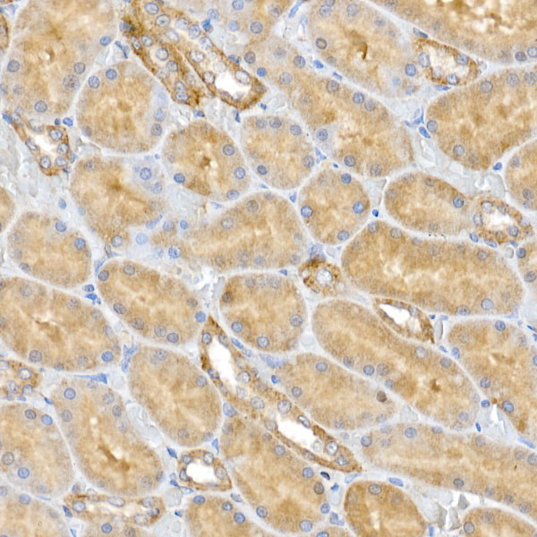 CLIC4 Antibody in Immunohistochemistry (Paraffin) (IHC (P))