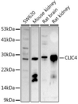 CLIC4 Antibody in Western Blot (WB)