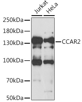 DBC1 Antibody in Western Blot (WB)