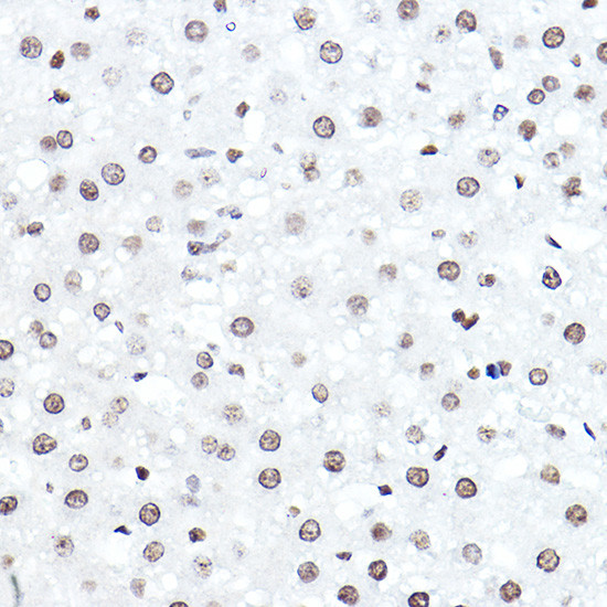 ELF5 Antibody in Immunohistochemistry (Paraffin) (IHC (P))