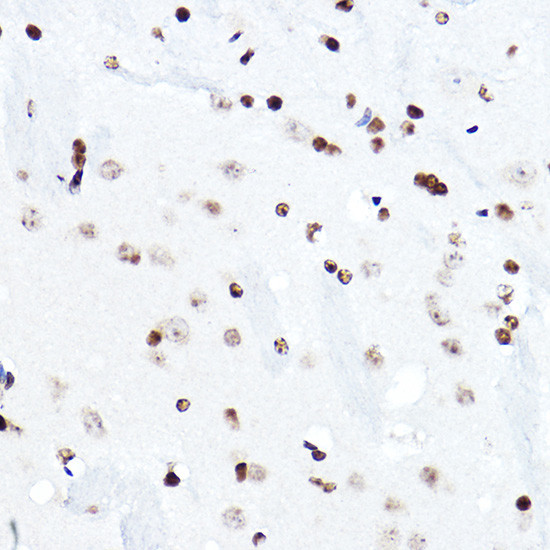 ELF5 Antibody in Immunohistochemistry (Paraffin) (IHC (P))