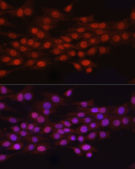 N6AMT1 Antibody in Immunocytochemistry (ICC/IF)