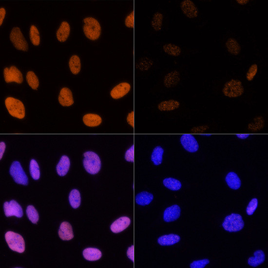 H3K14ac Antibody in Immunocytochemistry (ICC/IF)