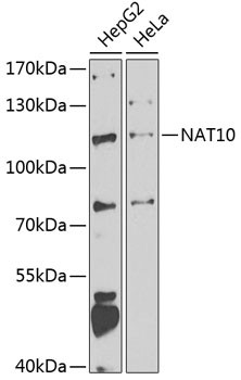 NAT10 Antibody in Western Blot (WB)