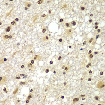 ZNF20 Antibody in Immunohistochemistry (Paraffin) (IHC (P))