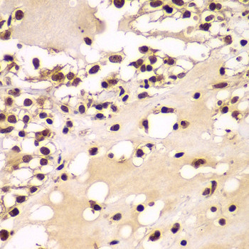 ZNF20 Antibody in Immunohistochemistry (Paraffin) (IHC (P))