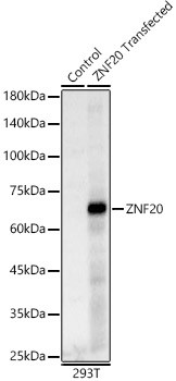 ZNF20 Antibody in Western Blot (WB)