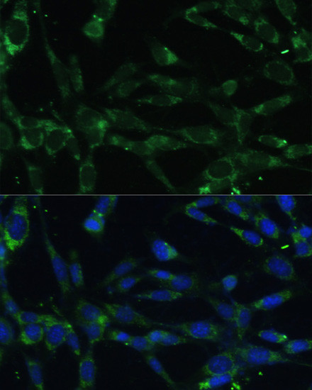 Calpain 5 Antibody in Immunocytochemistry (ICC/IF)