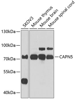 Calpain 5 Antibody in Western Blot (WB)