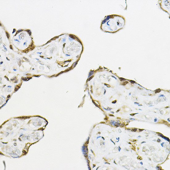 TEF5 Antibody in Immunohistochemistry (Paraffin) (IHC (P))