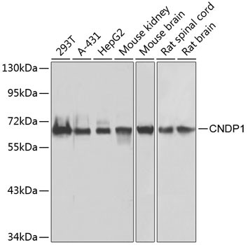 CNDP1 Antibody in Western Blot (WB)