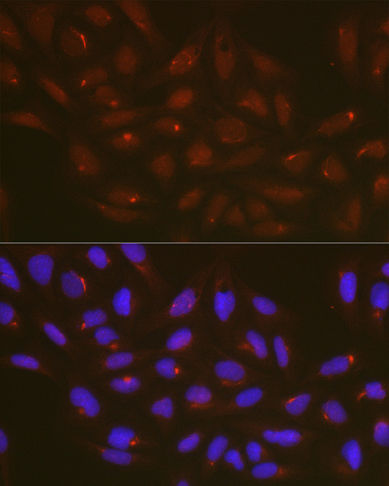 ATG14 Antibody in Immunocytochemistry (ICC/IF)