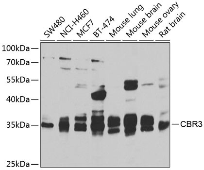 CBR3 Antibody in Western Blot (WB)