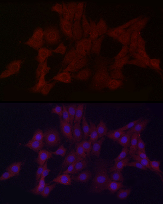 WDR45 Antibody in Immunocytochemistry (ICC/IF)