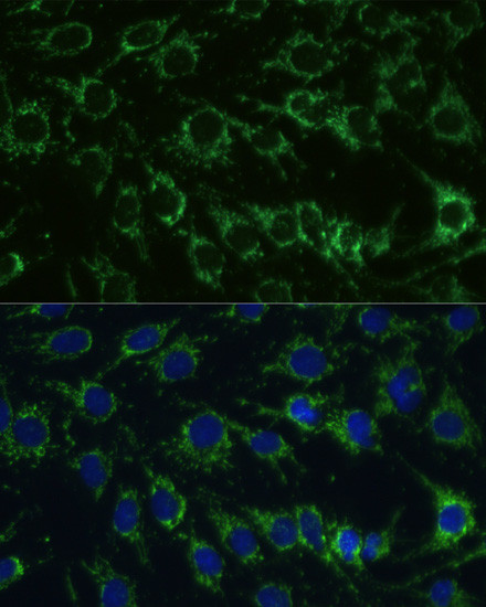 GluD1 Antibody in Immunocytochemistry (ICC/IF)