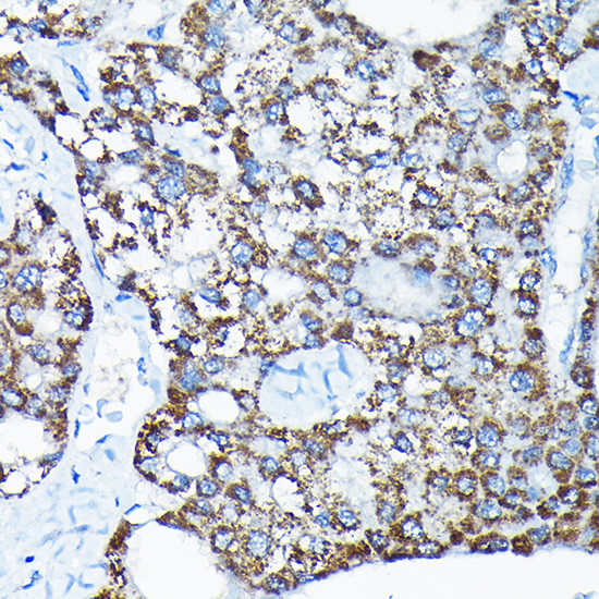 ETFA Antibody in Immunohistochemistry (Paraffin) (IHC (P))