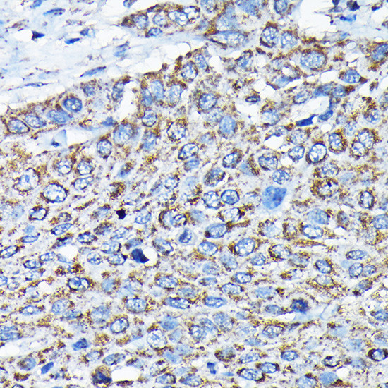 ETFA Antibody in Immunohistochemistry (Paraffin) (IHC (P))