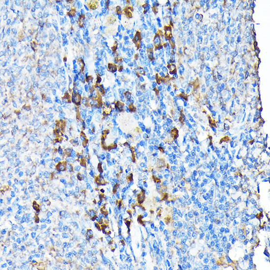 ETFA Antibody in Immunohistochemistry (Paraffin) (IHC (P))