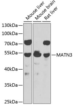 MATN3 Antibody in Western Blot (WB)