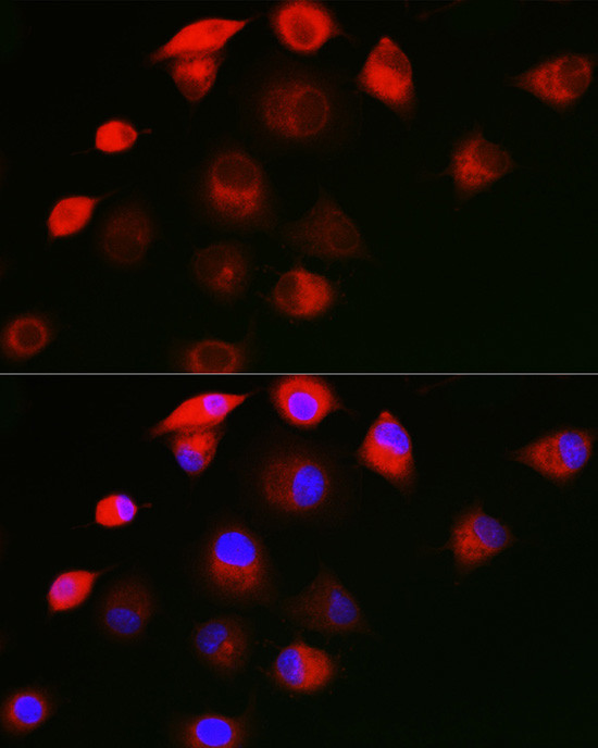 SHC Antibody in Immunocytochemistry (ICC/IF)