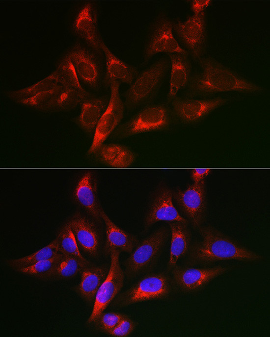 SHC Antibody in Immunocytochemistry (ICC/IF)