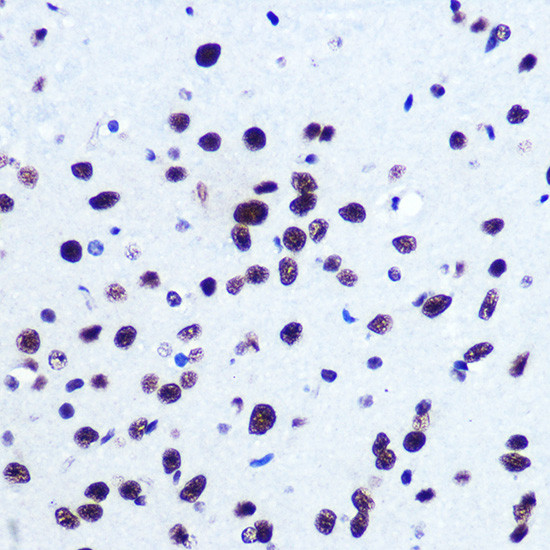 SRF Antibody in Immunohistochemistry (Paraffin) (IHC (P))