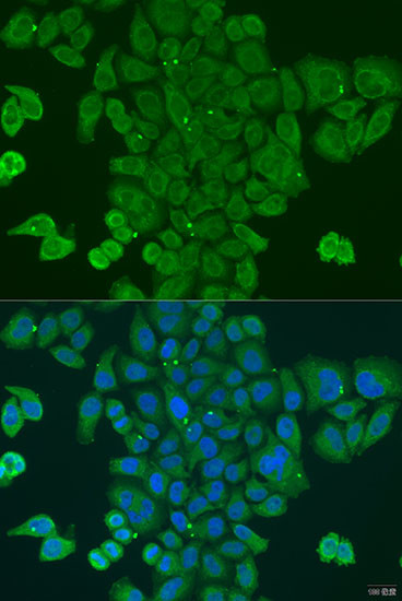 DPM1 Antibody in Immunocytochemistry (ICC/IF)