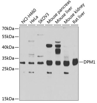 DPM1 Antibody in Western Blot (WB)